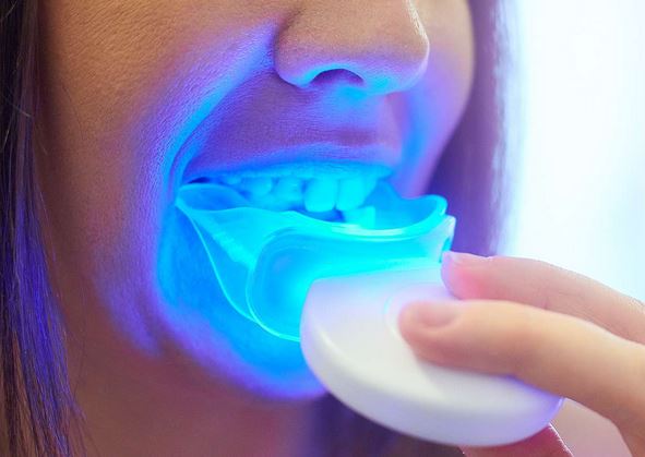  How to choose Teeth Whitening Kits