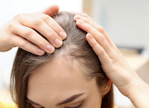  How to Combat Hair Loss