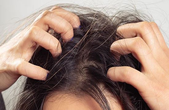 Natural Hair Care Remedies for Itchy Scalp