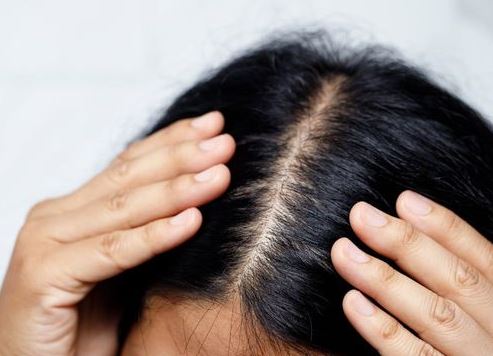 The Importance of Scalp Health for Overall Hair Growth